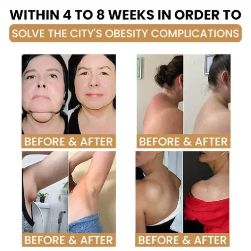 Ultrasonic Detox Watch Nurbini™ – Energy Balance