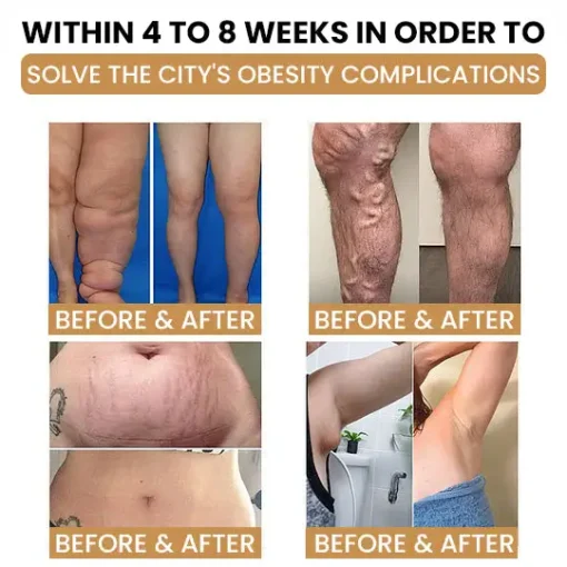 Ultrasonic Detox Watch Nurbini™ – Energy Balance