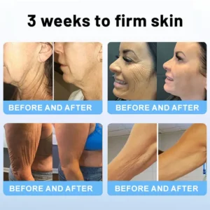 lysmus™ Wrinkle Removel Cream