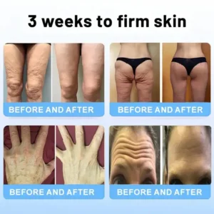 lysmus™ Wrinkle Removel Cream