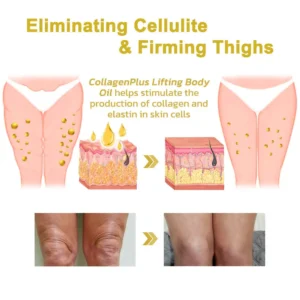 lysmus™ Wrinkle Removel Cream
