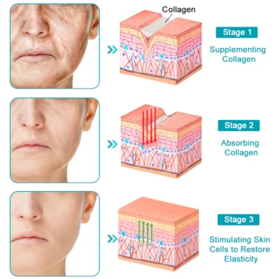 lysmus™ Wrinkle Removel Cream