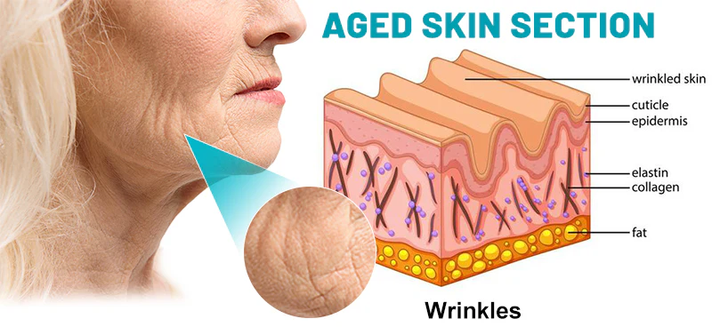 lysmus™ Wrinkle Removel Cream