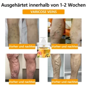 𝐎𝐲𝐢𝐤𝐞𝐲™ 𝐁𝐢𝐞𝐧𝐞𝐧𝐠𝐢𝐟𝐭 & 𝐊𝐮𝐫𝐤𝐮𝐦𝐚 𝐀𝐫𝐭𝐡𝐫𝐢𝐭𝐢𝐬 𝐓𝐡𝐞𝐫𝐚𝐩𝐢𝐞 𝐂𝐫𝐞𝐦𝐞