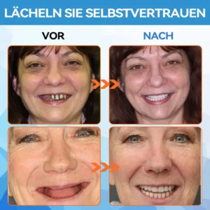 𝐁𝐢𝐤𝐞𝐧𝐝𝐚™𝐒𝐢𝐥𝐢𝐤𝐨𝐧 𝐑𝐞𝐥𝐢𝐧𝐞 𝐃𝐞𝐧𝐭𝐮𝐫𝐞 𝐒𝐞𝐭𝐳𝐞𝐧