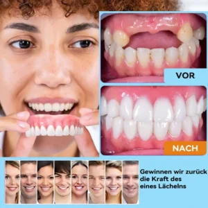 𝐁𝐢𝐤𝐞𝐧𝐝𝐚™𝐒𝐢𝐥𝐢𝐤𝐨𝐧 𝐑𝐞𝐥𝐢𝐧𝐞 𝐃𝐞𝐧𝐭𝐮𝐫𝐞 𝐒𝐞𝐭𝐳𝐞𝐧