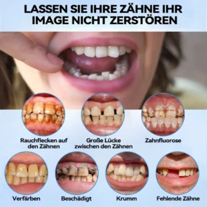 𝐁𝐢𝐤𝐞𝐧𝐝𝐚™𝐒𝐢𝐥𝐢𝐤𝐨𝐧 𝐑𝐞𝐥𝐢𝐧𝐞 𝐃𝐞𝐧𝐭𝐮𝐫𝐞 𝐒𝐞𝐭𝐳𝐞𝐧
