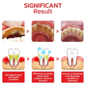 CC™️ SP4 Probiotic Whitening Toothpaste
