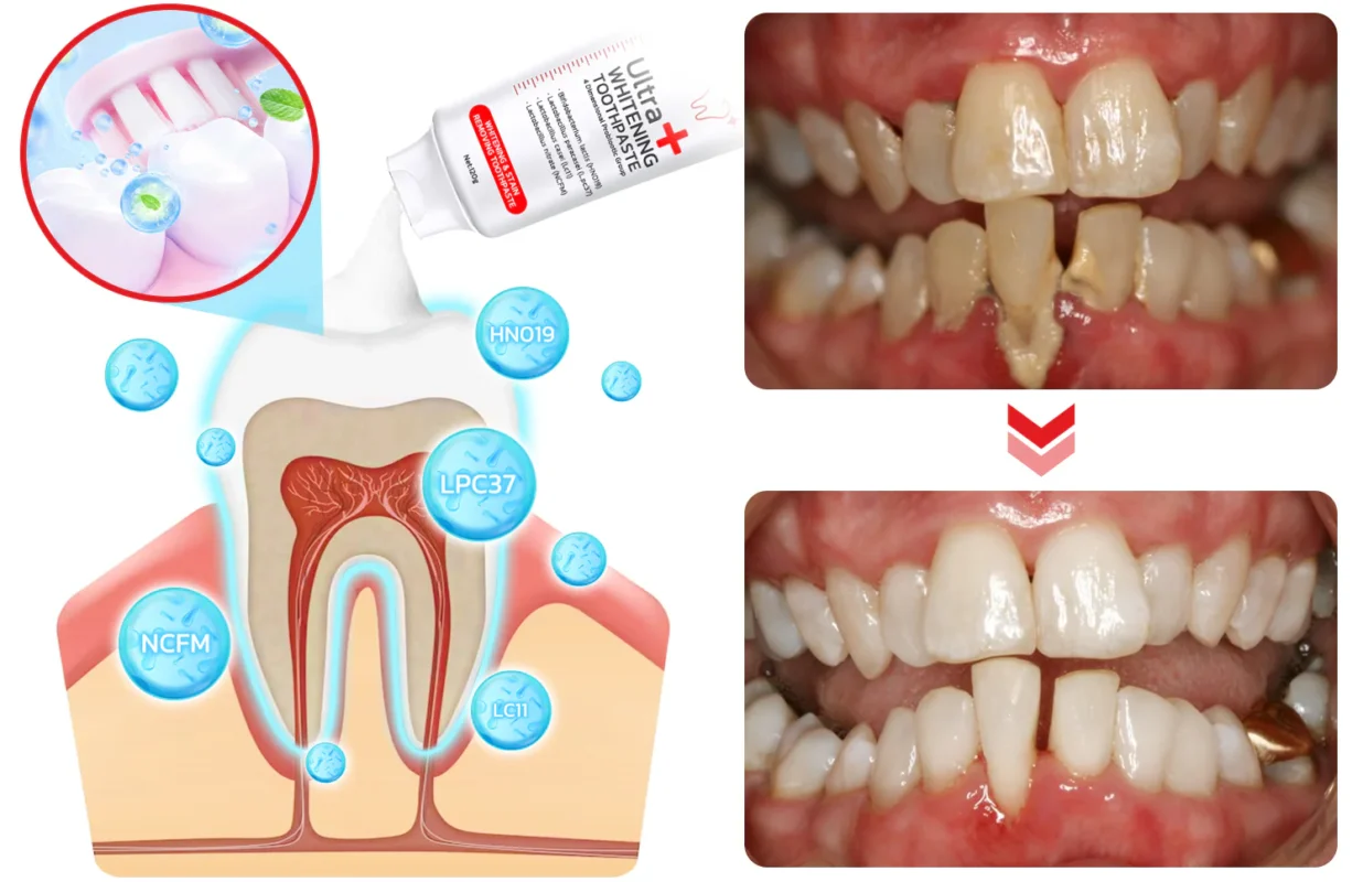 CC™️ SP4 Probiotic Whitening Toothpaste
