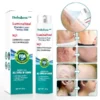Dobshow™ LuminaHeal Precision Scar Therapy Mist-For All Types of Scars - For example Acne Scars, Surgical Scars and Stretch Marks