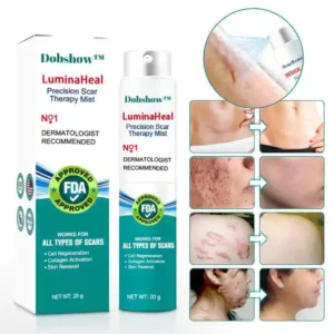 Dobshow™ LuminaHeal Precision Scar Therapy Mist-For All Types of Scars - For example Acne Scars, Surgical Scars and Stretch Marks