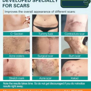 Dobshow™ LuminaHeal Precision Scar Therapy Mist-For All Types of Scars - For example Acne Scars, Surgical Scars and Stretch Marks