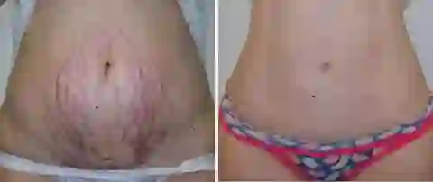Dobshow™ LuminaHeal Precision Scar Therapy Mist