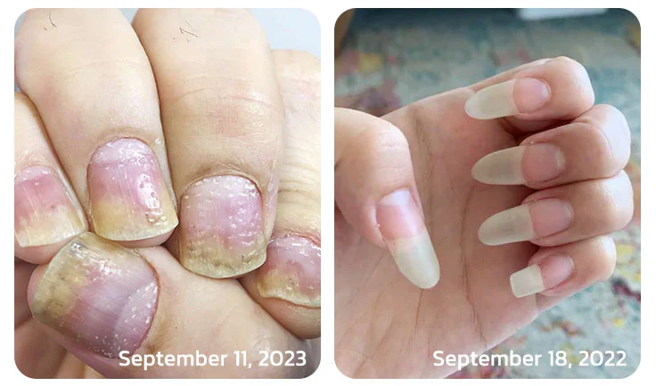 Fivfivgo™ Strong Bee Venom 7 Days Growth Nail Gel