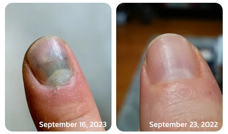 Fivfivgo™ Strong Bee Venom 7 Days Growth Nail Gel