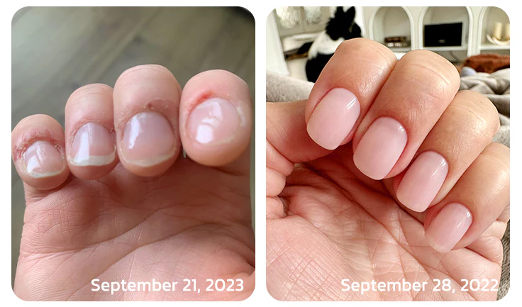 Fivfivgo™ Strong Bee Venom 7 Days Growth Nail Gel