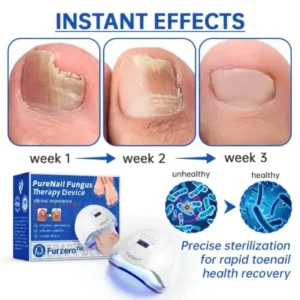 Furzero™ PureNail Fungus Laser Device