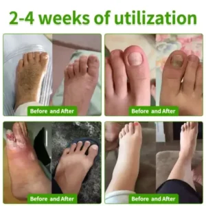 HZA™ FungiVanish Foot Treatment Spray