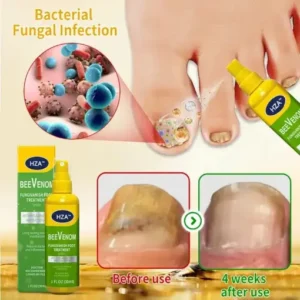 HZA™ FungiVanish Foot Treatment Spray