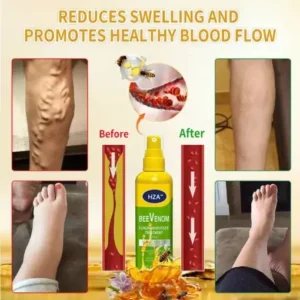 HZA™ FungiVanish Foot Treatment Spray