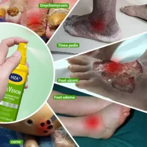 HZA™ FungiVanish Foot Treatment Spray