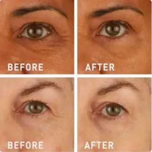 Instant FIRMx Temporary Eye Tightener