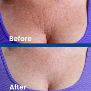 LIMETOW™ Luxe Collagen Firming Cream