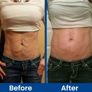 LIMETOW™ Luxe Collagen Firming Cream