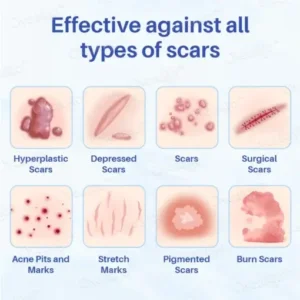 LOVILDS™Silicone Anti-Scar Cream
