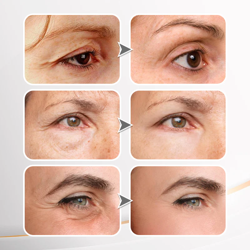 LOVILDS™ YouthfulLift Eye Firming Cream 5