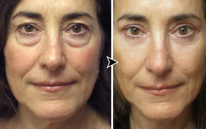 LOVILDS™ YouthfulLift Eye Firming Cream 5