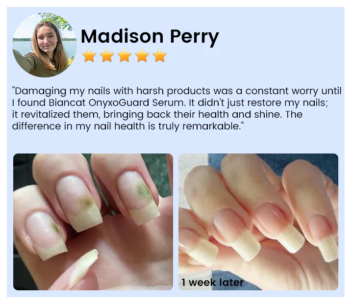 OnyxoGuard Nail Growth and Repair Serum