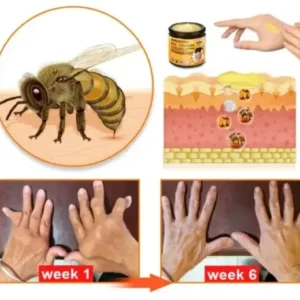 Raindew™ Bee Venom & Turmeric Joint and Bone Pain Relief Cream