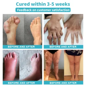 Raindew™ 𝐍𝐞𝐫𝐯𝐞 𝐑𝐞𝐥𝐢𝐞𝐟 𝐋𝐨𝐭𝐢𝐨𝐧