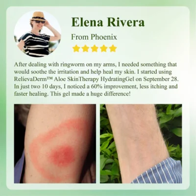 RelievaDerm™ Aloe SkinTherapy HydratingGel
