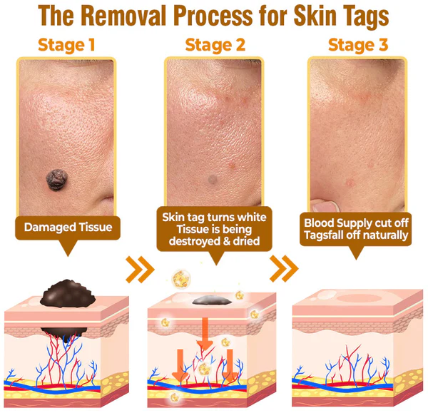 flysmus™ Bee Venom Comprehensive Skin Treatment Cream Dermatologist Approved 1