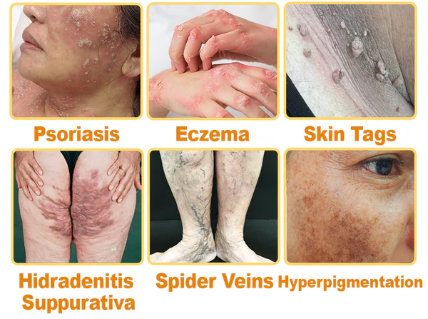 flysmus™ Bee Venom Comprehensive Skin Treatment Cream