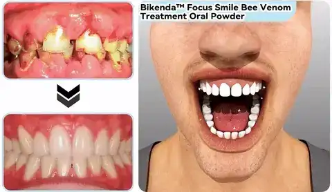𝐁𝐢𝐤𝐞𝐧𝐝𝐚™ 𝐅𝐨𝐜𝐮𝐬 𝐒𝐦𝐢𝐥𝐞 𝐁𝐞𝐞 𝐕𝐞𝐧𝐨𝐦 𝐓𝐫𝐞𝐚𝐭𝐦𝐞𝐧𝐭 𝐎𝐫𝐚𝐥 𝐏𝐨𝐰𝐝𝐞𝐫