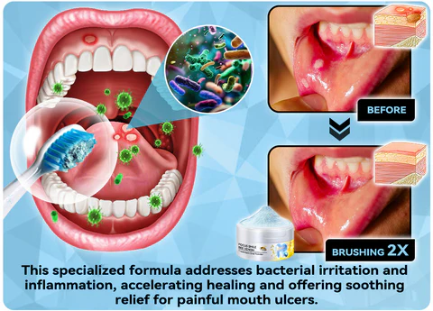𝐁𝐢𝐤𝐞𝐧𝐝𝐚™ 𝐅𝐨𝐜𝐮𝐬 𝐒𝐦𝐢𝐥𝐞 𝐁𝐞𝐞 𝐕𝐞𝐧𝐨𝐦 𝐓𝐫𝐞𝐚𝐭𝐦𝐞𝐧𝐭 𝐎𝐫𝐚𝐥 𝐏𝐨𝐰𝐝𝐞𝐫