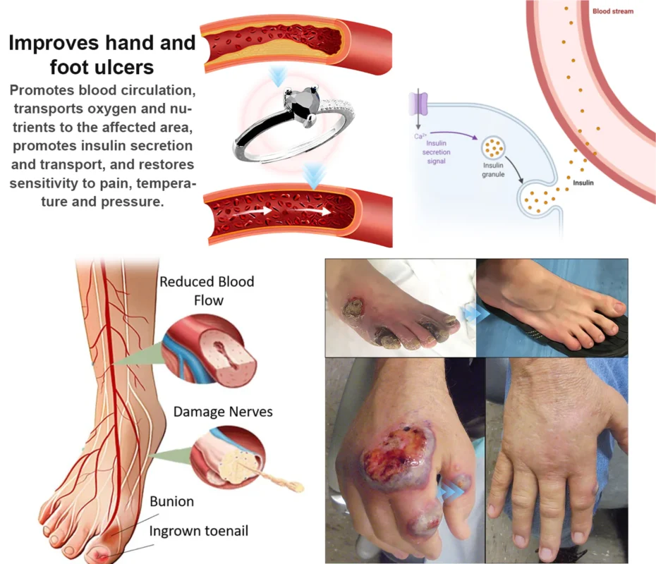 DIYSTAR™ Magnetic Lymp Drainage Health Ring