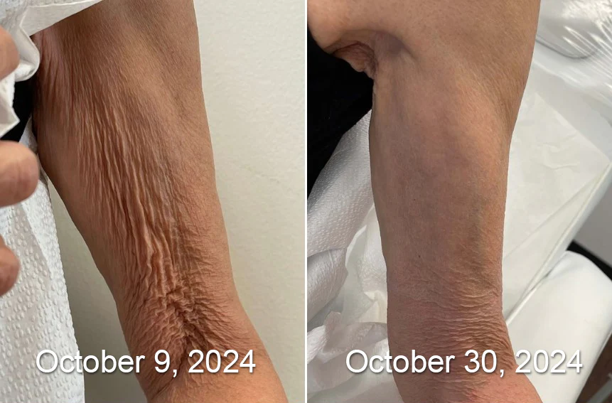 ApisDerm™ Botox BeeVenom WrinkleFirming Multi-Purpose Cream