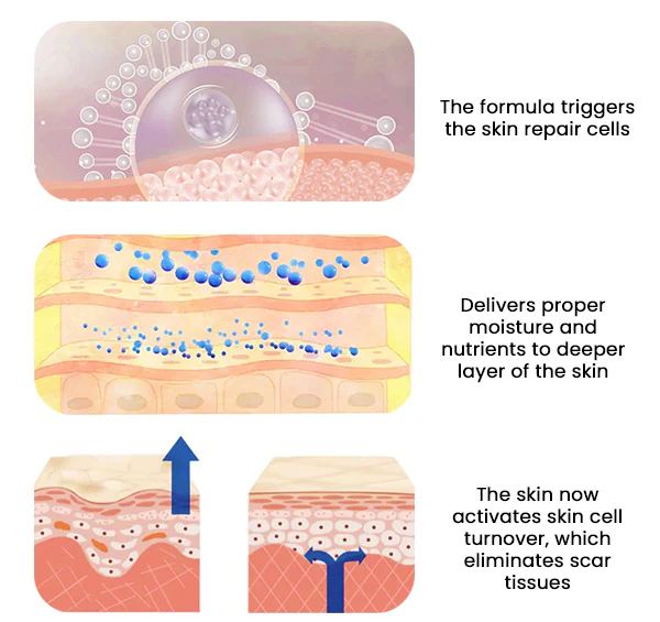 AEXZR™ Advance Scar Care Formulah