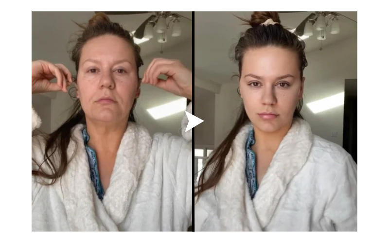 Biancat™ VDefine Face Lifting Tape