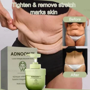 ADNOON™ 𝐋𝐮𝐱𝐮𝐫𝐢𝐨𝐮𝐬 𝐂𝐨𝐥𝐥𝐚𝐠𝐞𝐧 𝐅𝐢𝐫𝐦𝐢𝐧𝐠 𝐂𝐫𝐞𝐚𝐦