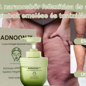 ADNOON™ 𝐋𝐮𝐱𝐮𝐫𝐢𝐨𝐮𝐬 𝐂𝐨𝐥𝐥𝐚𝐠𝐞𝐧 𝐅𝐢𝐫𝐦𝐢𝐧𝐠 𝐂𝐫𝐞𝐚𝐦