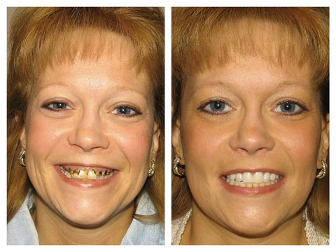 AQA™ NEW TEETH Mouthwash - Solve all Oral Problems