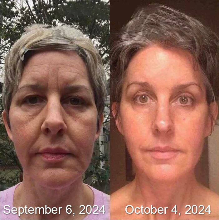 ApisDerm™ Botox BeeVenom WrinkleFirming Multi-Purpose Cream
