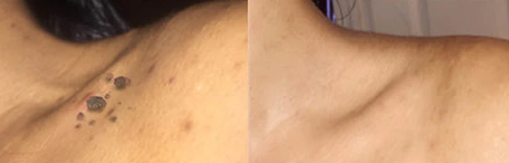Biancat™ Intensive Skin Care Cream