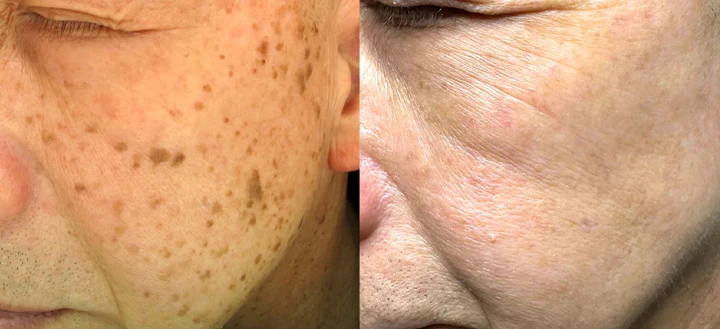 Biancat™ PureVenom Skin Revitalizing Cream