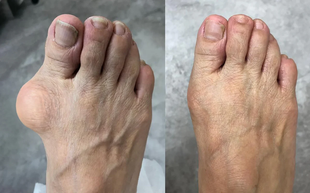 CROAIE™ Hyaluronic Acid Joint Repair Cream